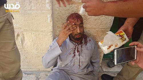 Sept Palestiniens et trois Sud-Africains kidnappés en Cisjordanie occupée, cinq Palestiniens blessés à Al-Aqsa (vidéo)